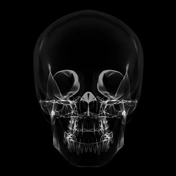 X 射线头骨 — 图库照片