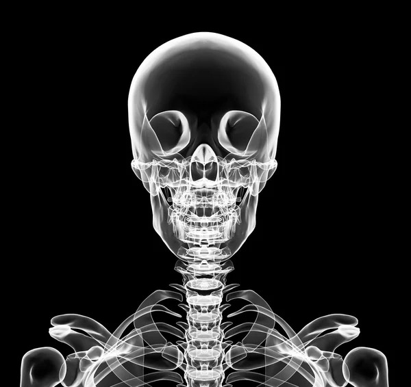 X-ray a koponya felső mellkasi tartalmazza — Stock Fotó