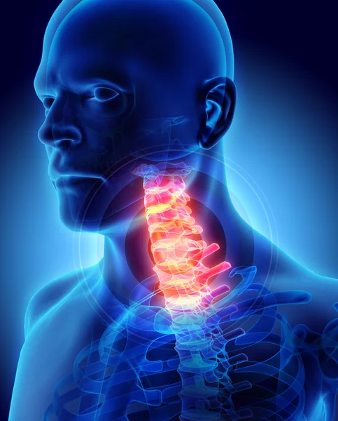 Cuello doloroso: radiografía del esqueleto de la columna vertebral del cuello uterino, ilustración 3D . — Foto de Stock