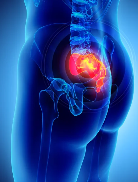 sakrum acı 3D çizimi.