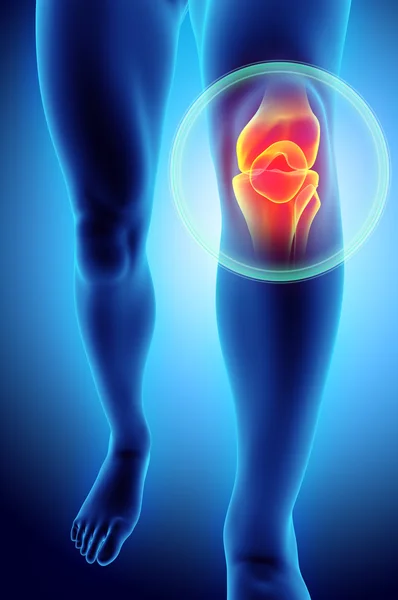 Knie schmerzhaft - Skelett röntgen. — Stockfoto