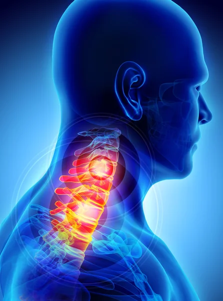Dor no pescoço - Raio-X do esqueleto da coluna vertebral, ilustração 3D . — Fotografia de Stock