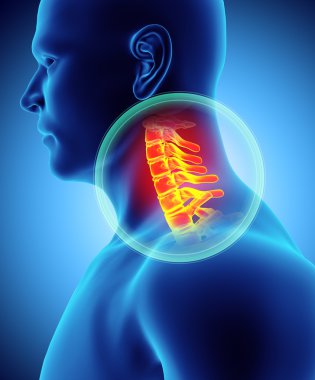 Neck painful - cervica spine skeleton x-ray, 3D illustration. clipart