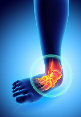 Ayak bileği acı - iskelet x-ray.
