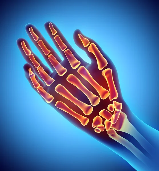 Ilustración 3D de Hand Skeleton, concepto médico . — Foto de Stock