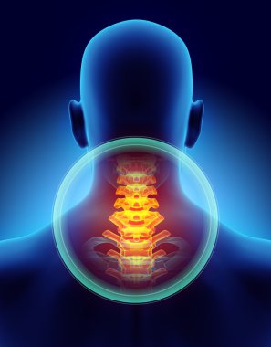 Boyun Ağrılı - cervica omurga iskelet x-ray, 3d çizim.