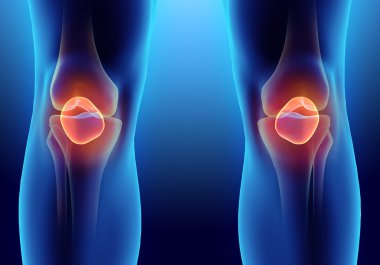 Patella, tıbbi kavramı 3D çizimi.