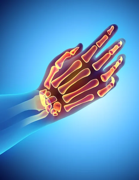 3D illustration of Hand Skeleton, medical concept. — Stock Photo, Image