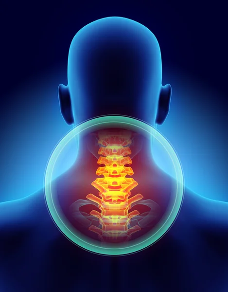 Boyun Ağrılı - cervica omurga iskelet x-ray, 3d çizim.