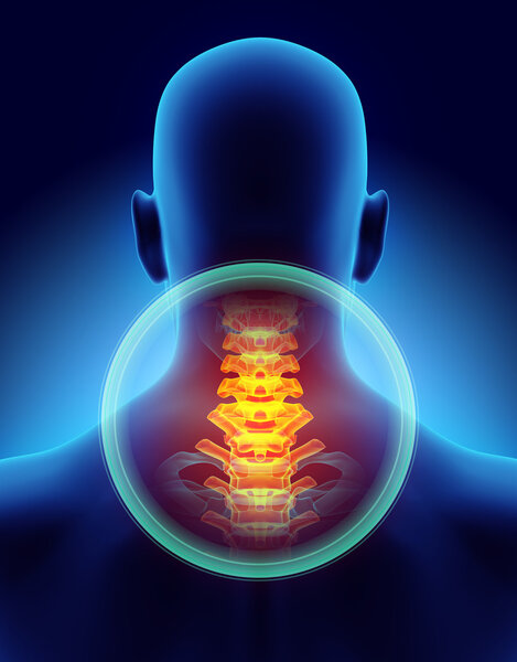 Neck painful - cervica spine skeleton x-ray, 3D illustration.