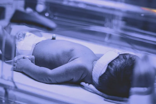 Newborn baby under ultraviolet lamp is getting treated for jaundice (elevated bilirubin) in Vancouver hospital