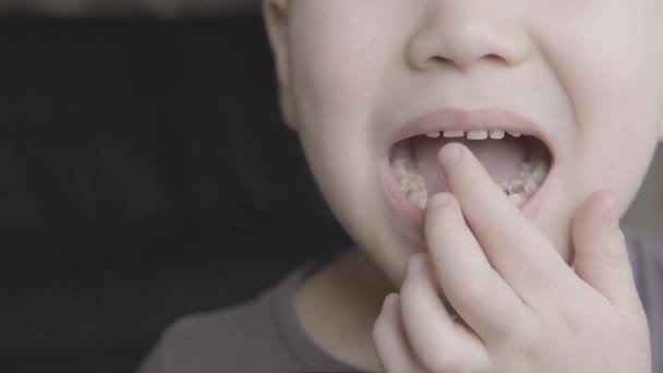 Мальчик раскачивает язык и пальцы передним детским зубом — стоковое видео