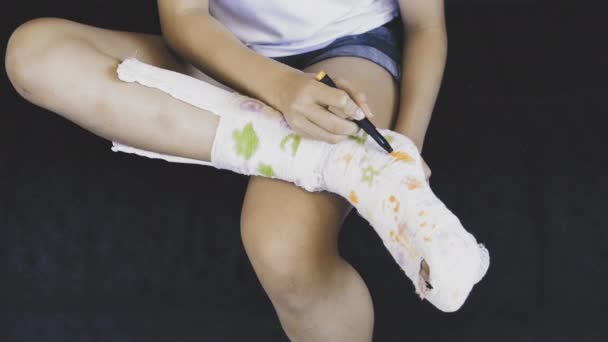 Adolescente dessine sur une jambe dans un plâtre. Une façon de s'amuser avec une jambe cassée.Fracture du pied. Jambe cassée — Video