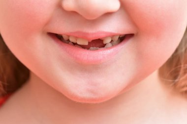 İlk bebek dişleri dökülen çocuk gülüşü