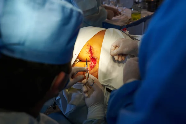 Surgery. A surgeon sutures the skin. Medical intervention.