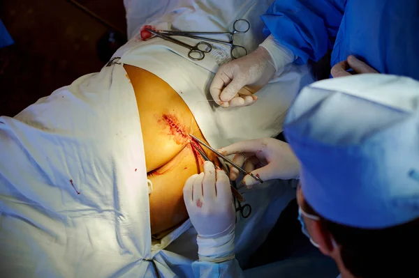 Operation Chirurg Näht Die Wunde Blick Von Oben — Stockfoto