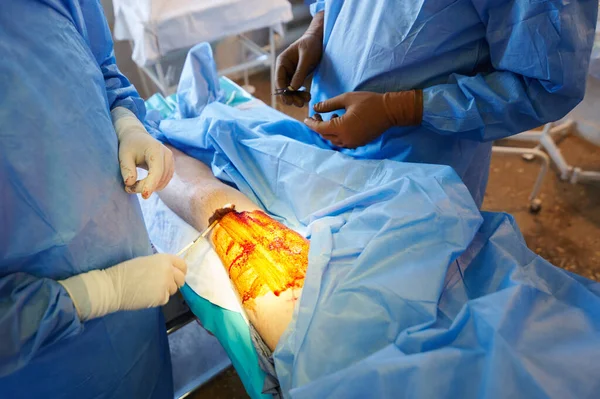 Хирургия Лечение Операционного Поля Антисептическим Раствором — стоковое фото
