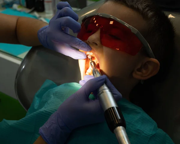 小児歯科医は 診療所で小さな男の子の歯を治療します 歯医者に行く男の子 — ストック写真