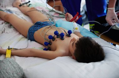 Elektrokardiyografi. Elektrokardiyogramdaki kalp kaslarının incelenmesi. ECG kontrolünde öğrenci.