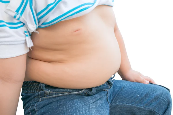 El tamaño del estómago de los niños con sobrepeso . — Foto de Stock