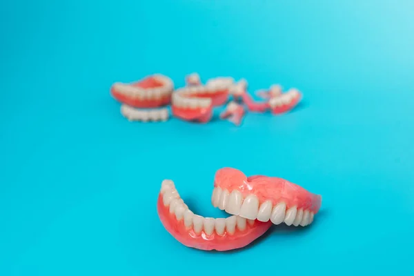 Mavi Arka Planda Takma Dişler Takma Dişlerin Yakın Plan Çekimi — Stok fotoğraf