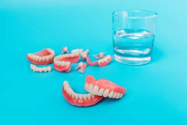 Dentures Blue Background Close Dentures Full Removable Plastic Denture Jaws — Stock Photo, Image