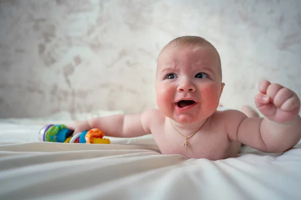 Κοντινό Πλάνο Ενός Μωρού Αλλεργία Στο Δέρμα Ξαπλωμένο Στο Κρεβάτι — Φωτογραφία Αρχείου