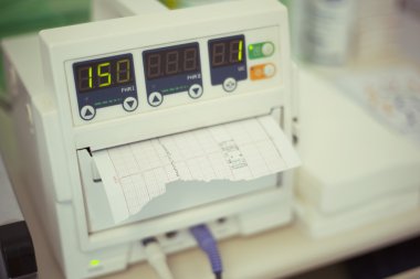 Cenin kalp atışı monitör, cardiotocography