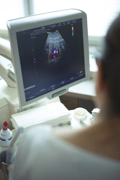 Máquina de ultra-som no consultório médico — Fotografia de Stock