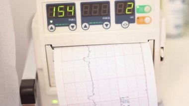 Cenin kalp atışı monitör, cardiotocography