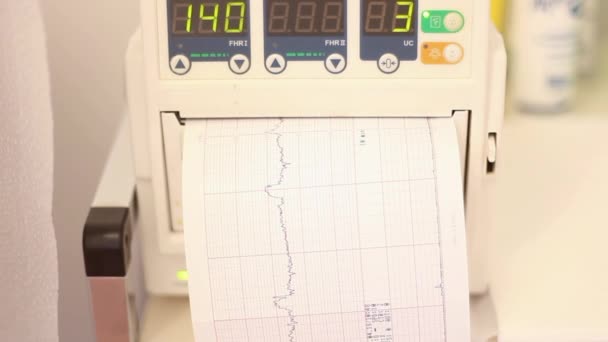 Monitor do batimento cardíaco fetal, cardiotocografia — Vídeo de Stock