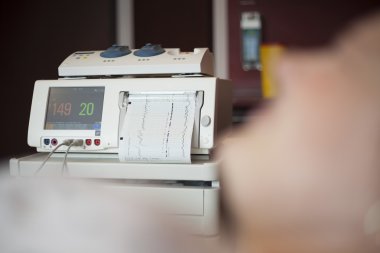 Cenin kalp atışı monitör, cardiotocography 