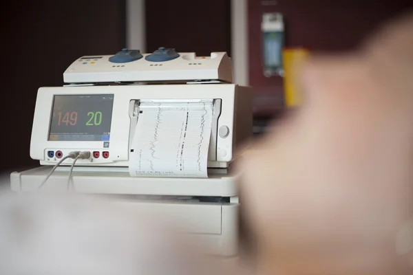 Cenin kalp atışı monitör, cardiotocography 