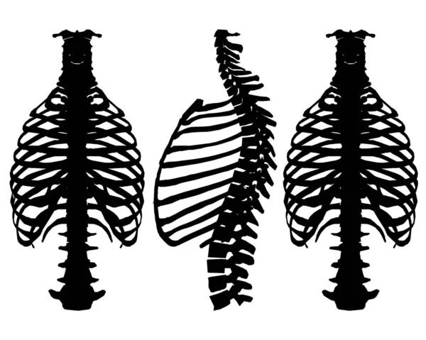 白い背景に隔離されたさまざまな位置に人間の胸と背骨の骨格のシルエットが設定されています。ベクターイラスト — ストックベクタ