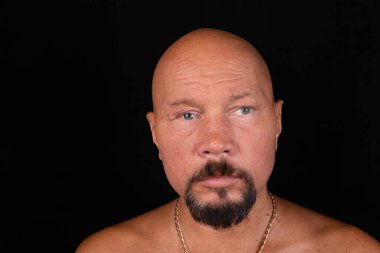 Kozmetik göz protezi olan bir adamın portresi. Glokom hastalığının sonuçları. Seçici odak.