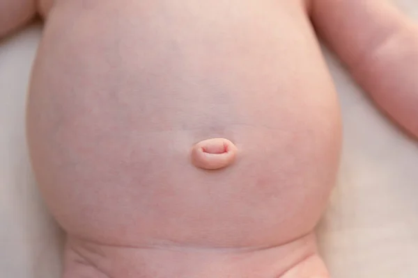 Gezonde Navel Van Pasgeboren Baby Jongen Een Maand Oud — Stockfoto