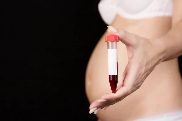 Hamile Bir Kadın Önünde Bir Tüp Kan Tutuyor Hamilelik Laboratuvarda — Stok fotoğraf