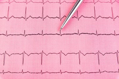 Gümüş kalem ve kardiyogram hattı kapatın.