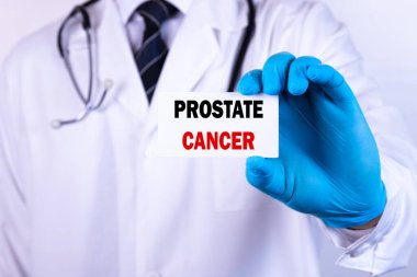 Doktor elinde yazılı prostat kanseri tıbbi konsepti olan bir kart tutuyor.