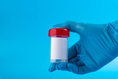 Mavi eldivenli bir doktorun ya da hemşirenin elleri mavi arka planda boş bir analiz kabı tutuyor..