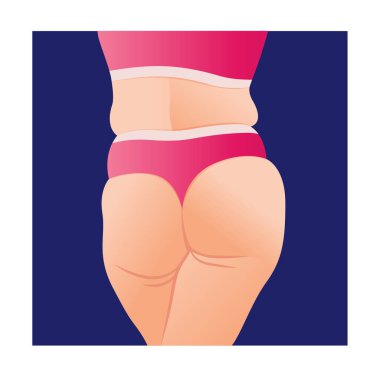 overweight female body, fat woman with cellulitis on buttocks. butt icon for mobile apps, fat body, vector illustration.