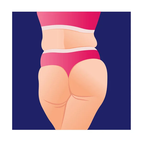 Overweight Female Body Fat Woman Cellulitis Buttocks Butt Icon Mobile — Vetor de Stock