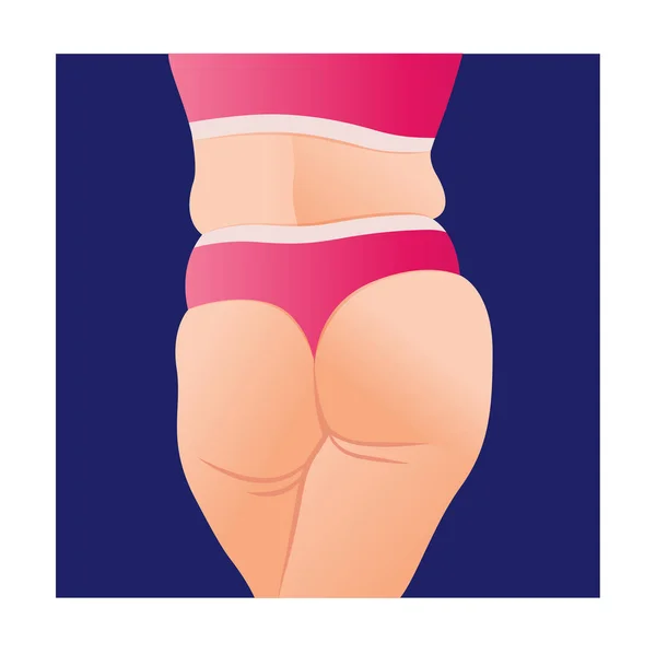 Corps Féminin Surpoids Femme Grasse Avec Cellulite Sur Les Fesses — Image vectorielle