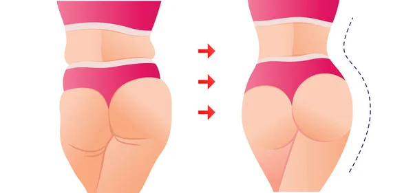 Grasa Para Adaptarse Transformación Del Cuerpo Las Mujeres Antes Después — Vector de stock