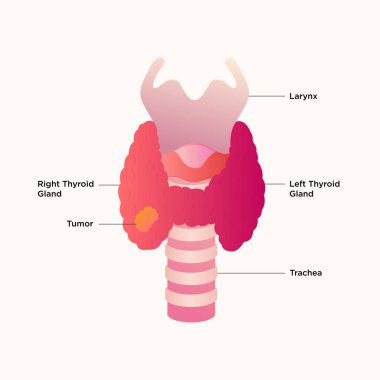 Tiroid bezi ve gırtlak diyagramı. Tiroid kanseri. Tiroid bezi tıbbi konsepti trakea ve gırtlağı endokrinoloji sisteminin sembolü olan bir insan organıdır.