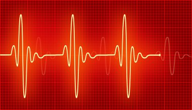 Parlak kardiyogram dalgalar