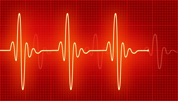 Parlak kardiyogram dalgalar