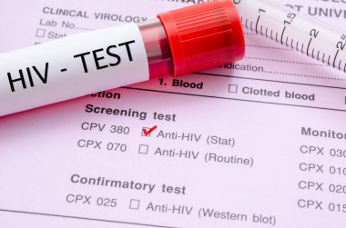 Sınama formu eleme HIV enfeksiyonu.