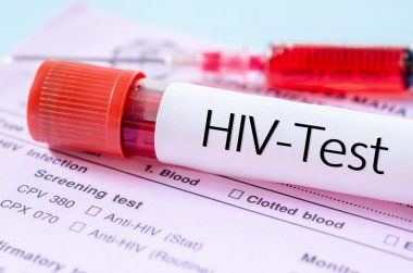Sınama formu eleme HIV enfeksiyonu HIV testi etiketinde.
