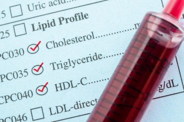 Kolesterol, trigliserid ve Hdl-Con istek üzerine kırmızı işareti onay 